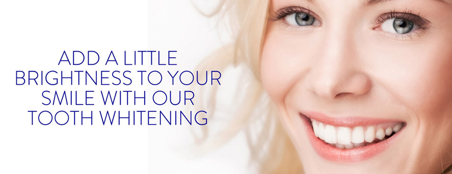 tooth-whitening-agamaly tooth whitening agamaly